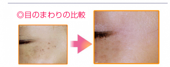 目のまわりの比較