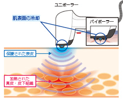 サーモ・シェイプのメカニズム